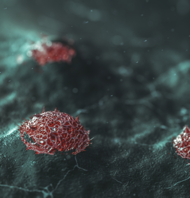 Carcinoma