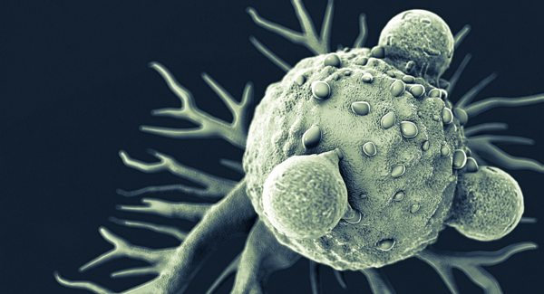 Solid Tumors